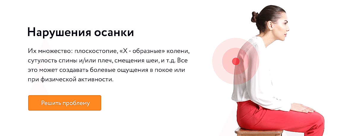 Нарушения осанки
